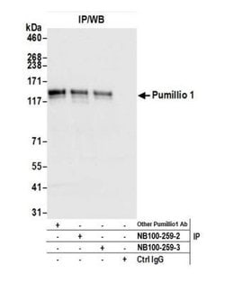 PUM1 Antibody, Novus Biologicals 100 &mu;L | Buy Online | Novus Biologicals | Fisher Scientific