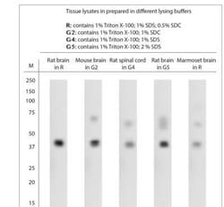 Pejvakin Antibody, Novus Biologicals 0.025 mL; Unconjugated:Antibodies,