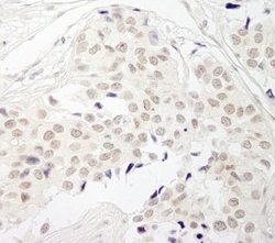 Protein Phosphatase 1 beta Antibody, Novus Biologicals 0.1mL; Unlabeled:Antibodies,