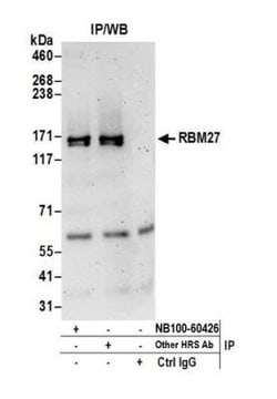 RBM27 Antibody, Novus Biologicals 0.1mg; Unlabeled:Antibodies, Polyclonal