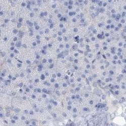 RCN2 Antibody, Novus Biologicals:Antibodies:Primary Antibodies
