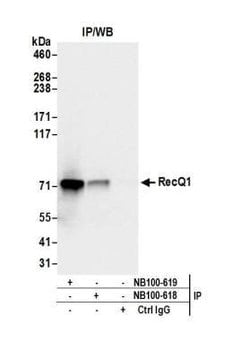RECQ1 Antibody, Novus Biologicals 0.1mg; Unlabeled:Antibodies, Polyclonal