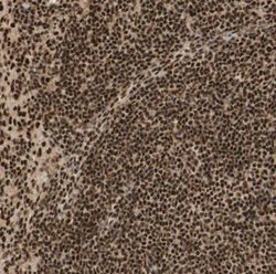 RNF113A Antibody, Novus Biologicals 0.1 mL | Buy Online | Novus Biologicals | Fisher Scientific