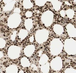 RNF113A Antibody, Novus Biologicals 0.1 mL | Buy Online | Novus Biologicals | Fisher Scientific