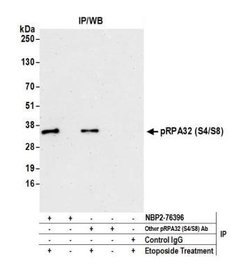 RPA2, p Ser8, p Ser4 Antibody (BL-165-5F1), Novus Biologicals 100 &mu;L | Buy Online | Novus Biologicals | Fisher Scientific