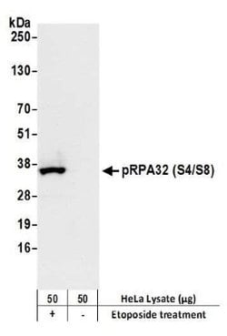 RPA2, p Ser8, p Ser4 Antibody (BL-165-5F1), Novus Biologicals 100 &mu;L | Buy Online | Novus Biologicals | Fisher Scientific