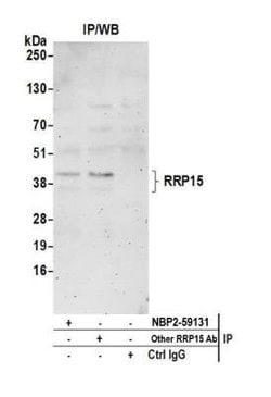 RRP15 Antibody, Novus Biologicals 100&mu;L; Unlabeled:Antibodies, Polyclonal