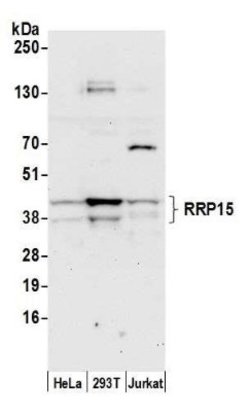 RRP15 Antibody, Novus Biologicals 100&mu;L; Unlabeled:Antibodies, Polyclonal