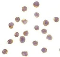 RSK1 Antibody - BSA Free, Novus Biologicals 0.025mg:Antibodies, Polyclonal