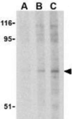 RSK1 Antibody - BSA Free, Novus Biologicals 0.025mg:Antibodies, Polyclonal