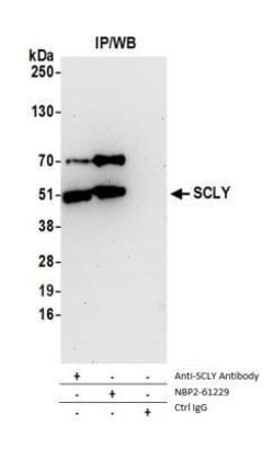 SCLY Rabbit anti-Human, Mouse, Polyclonal, Novus Biologicals 0.1mL:Antibodies,