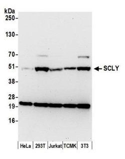 SCLY Rabbit anti-Human, Mouse, Polyclonal, Novus Biologicals 0.1mL:Antibodies,