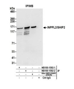 SHIP2/INPPL1 Antibody, Novus Biologicals 0.1mg; Unlabeled:Antibodies, Polyclonal
