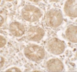 SHISA3 Antibody - BSA Free, Novus Biologicals 0.025 mg | Buy Online | Novus Biologicals | Fisher Scientific