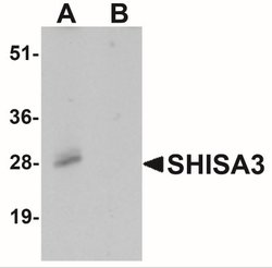SHISA3 Antibody - BSA Free, Novus Biologicals 0.025 mg | Buy Online | Novus Biologicals | Fisher Scientific