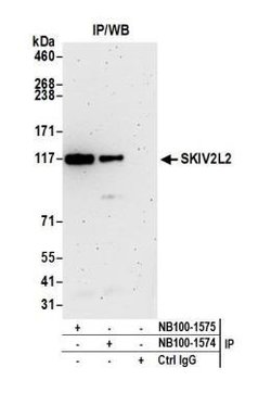 SKIV2L2 Antibody, R D Systems 0.1 mL | Buy Online | R&D Systems | Fisher Scientific