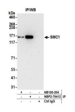 SMC1 Antibody (BL-205-2G8), Novus Biologicals 100 &mu;L | Buy Online | Novus Biologicals | Fisher Scientific
