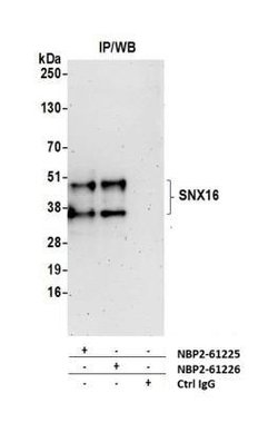 SNX16 Rabbit anti-Human, Polyclonal, Novus Biologicals 0.1mL:Antibodies,