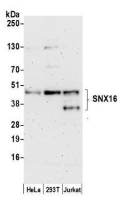 SNX16 Rabbit anti-Human, Polyclonal, Novus Biologicals 0.1mL:Antibodies,