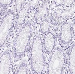 SP9 Antibody, Novus Biologicals 25 &mu;L, Unlabeled:Antibodies, Polyclonal