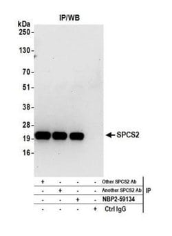 SPCS2 Rabbit anti-Human, Mouse, Polyclonal, Novus Biologicals 100&mu;L;