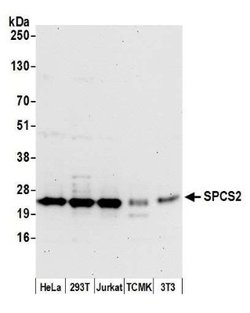 SPCS2 Rabbit anti-Human, Mouse, Polyclonal, Novus Biologicals 100&mu;L;