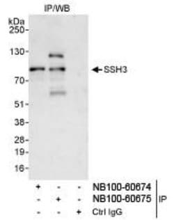 SSH3 Antibody, Novus Biologicals 0.1mg; Unlabeled:Antibodies, Polyclonal