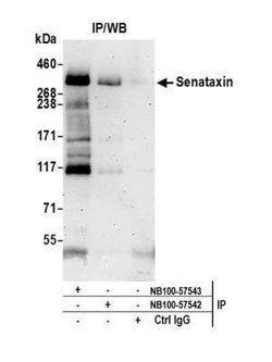 Senataxin Antibody, Novus Biologicals 100 &mu;L | Buy Online | Novus Biologicals | Fisher Scientific