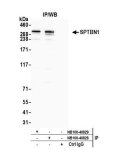Spectrin beta 2 Antibody, Novus Biologicals 0.1mL; Unlabeled:Antibodies,