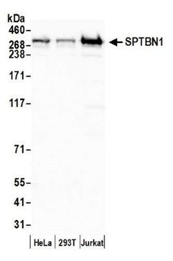 Spectrin beta 2 Antibody, Novus Biologicals 0.1mL; Unlabeled:Antibodies,