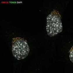TGN38 Antibody, Novus Biologicals:Antibodies:Primary Antibodies