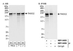 THOC2 Antibody, Novus Biologicals 100 &mu;L | Buy Online | Novus Biologicals | Fisher Scientific