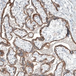 THSD7A Antibody, Novus Biologicals 25 &mu;L, Unlabeled:Antibodies, Polyclonal