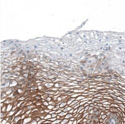 THSD7A Antibody, Novus Biologicals 25 &mu;L, Unlabeled:Antibodies, Polyclonal