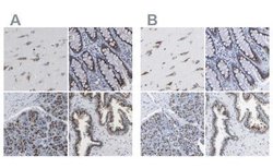 TMEM87A Antibody, Novus Biologicals 25 &mu;L; Unlabeled:Antibodies, Polyclonal