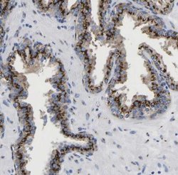TMEM87A Antibody, Novus Biologicals 25 &mu;L; Unlabeled:Antibodies, Polyclonal