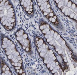 TMEM87A Antibody, Novus Biologicals 25 &mu;L; Unlabeled:Antibodies, Polyclonal