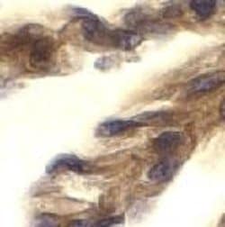 TRIF/TICAM1 Antibody, Novus Biologicals 0.025mg:Antibodies, Polyclonal