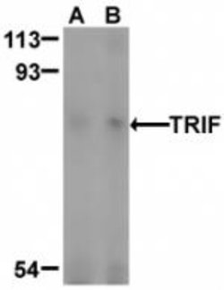 TRIF/TICAM1 Antibody, Novus Biologicals 0.025mg:Antibodies, Polyclonal