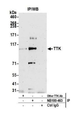 TTK Antibody, Novus Biologicals 0.1mg; Unlabeled:Antibodies, Polyclonal