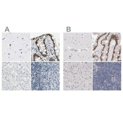 Th-POK Antibody, Novus Biologicals 25 &mu;L; Unlabeled:Antibodies, Polyclonal