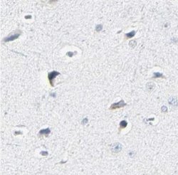 Th-POK Antibody, Novus Biologicals 25 &mu;L; Unlabeled:Antibodies, Polyclonal