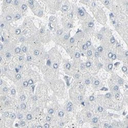 Th-POK Antibody, Novus Biologicals 25 &mu;L; Unlabeled:Antibodies, Polyclonal