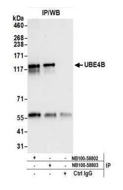 UBE4B Antibody, Novus Biologicals 0.1mL; Unlabeled:Antibodies, Polyclonal