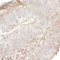 USP13 Antibody, Novus Biologicals 0.1mg; Unlabeled:Antibodies, Polyclonal