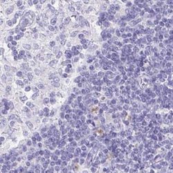 VIAAT/SLC32A1/VGAT Antibody, Novus Biologicals:Antibodies:Primary Antibodies