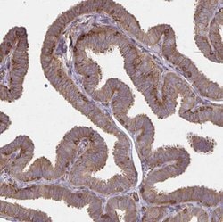 WASF2 Antibody, Novus Biologicals:Antibodies:Primary Antibodies