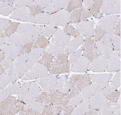 WASF2 Antibody, Novus Biologicals:Antibodies:Primary Antibodies