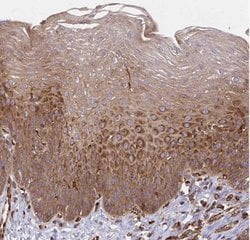 WASF2 Antibody, Novus Biologicals:Antibodies:Primary Antibodies