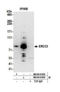 XPB Antibody, Novus Biologicals 0.1mg; Unlabeled:Antibodies, Polyclonal